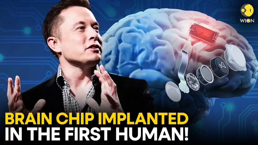 ⁣Breaking News: Elon Musk's Brain Chip Implant Breakthrough!